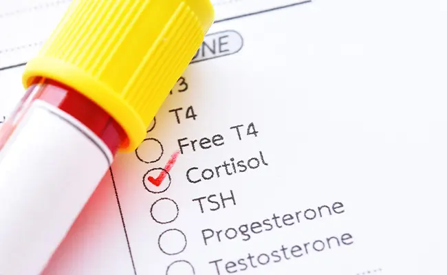Cortisol: More Than Just the Stress Hormone